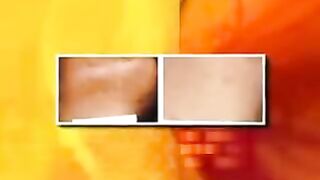 ZeddWellMD Laser Hair Removal