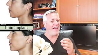 Chin Implant vs. Filler vs. Sliding Genioplasty: Which Is Right for You?