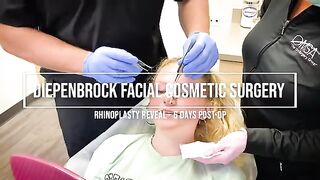 Rhino REVEAL - 6 Days PO