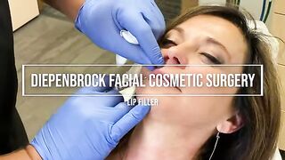 Wow! Lip Filler with Dr. Diepenbrock!!
