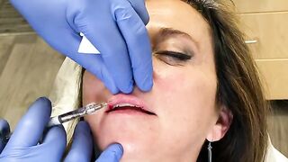 Wow! Lip Filler with Dr. Diepenbrock!!