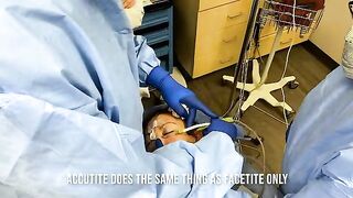 FaceTite and Morpheous 8 Facial Rejuvenation