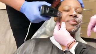 Morpheus8 with Dr. Diepenbrock Fort Wayne and Warsaw Indiana