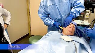 FACEtite with Dr. Diepenbrock Fort Wayne and Warsaw Indiana
