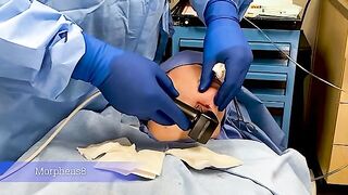 FACEtite with Dr. Diepenbrock Fort Wayne and Warsaw Indiana