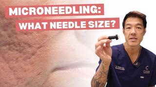 Microneedling: What Needle Size Is the Best?