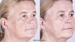 Prevent & Treat Sun-Induced Pigmentation | Dr Davin Lim