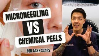 Microneedling vs Chemical Peels - Which is Better? | Dr Davin LIm