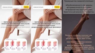 Лазерная эпиляция на ipl аппарате