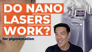 What are Nano Lasers? | Dr Davin Lim Pigmentation Series