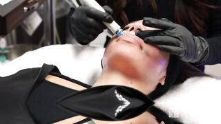 Is HydraFacial for you?