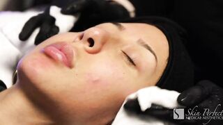 Is HydraFacial for you?
