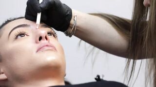 Fixing my Italian crooked nose - without surgery!